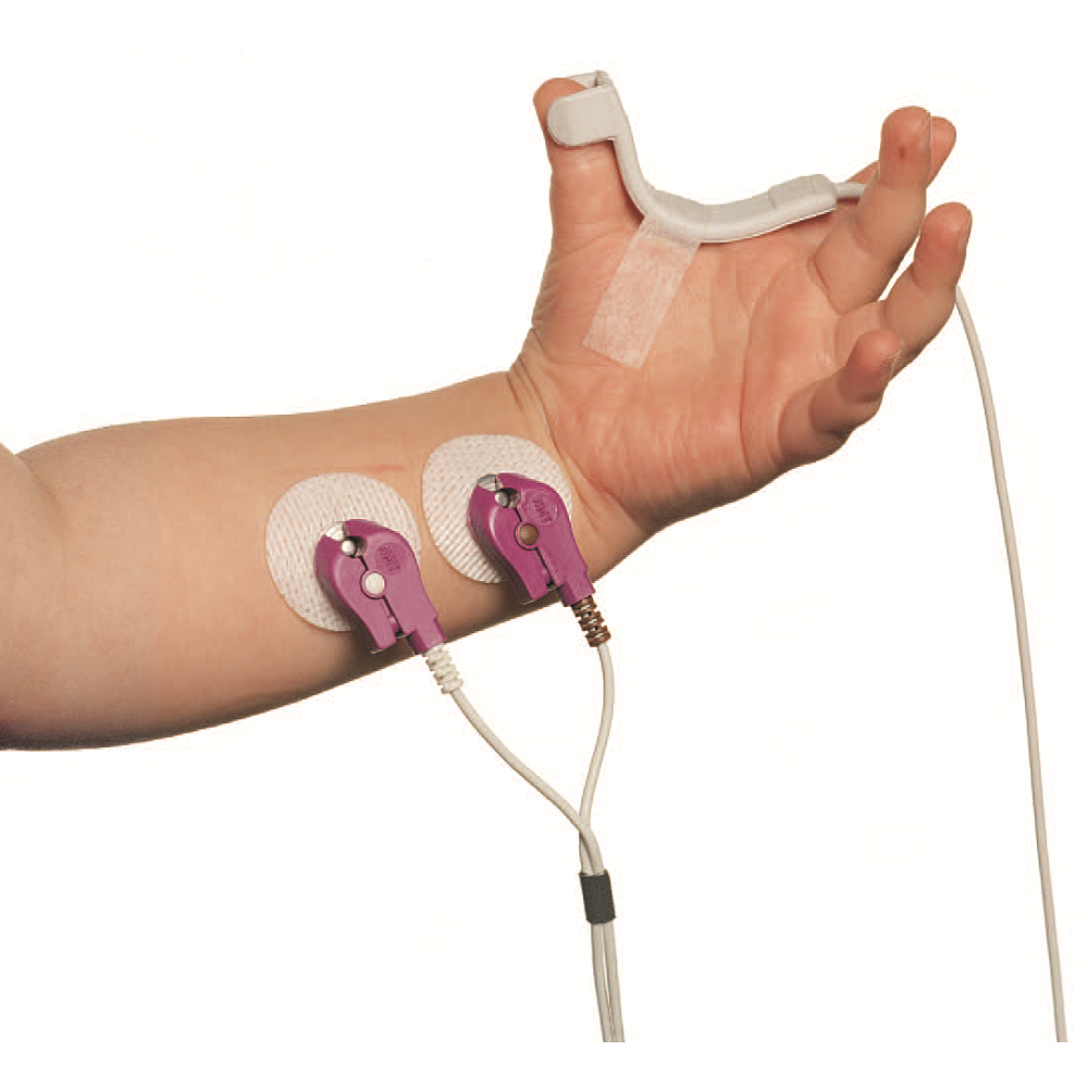 NMT MechanoSensor Pediátrico, 0,3 m/1 pé, Único. NMT MechanoSensor Pediátrico, 0,3 m/1 pé, Único.